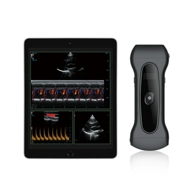 Mobile Ultrasound Imaging